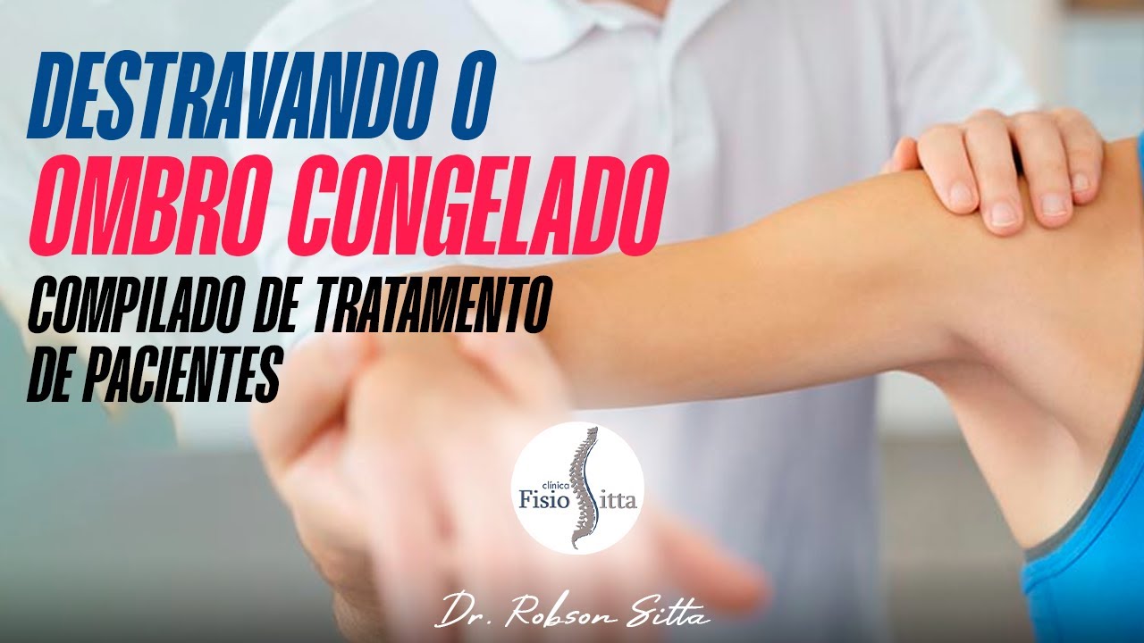 CAPSULITE ADESIVA DO OMBRO - OMBRO CONGELADO TRATAMENTO DE FISIOTERAPIA Dr. Robson Sitta