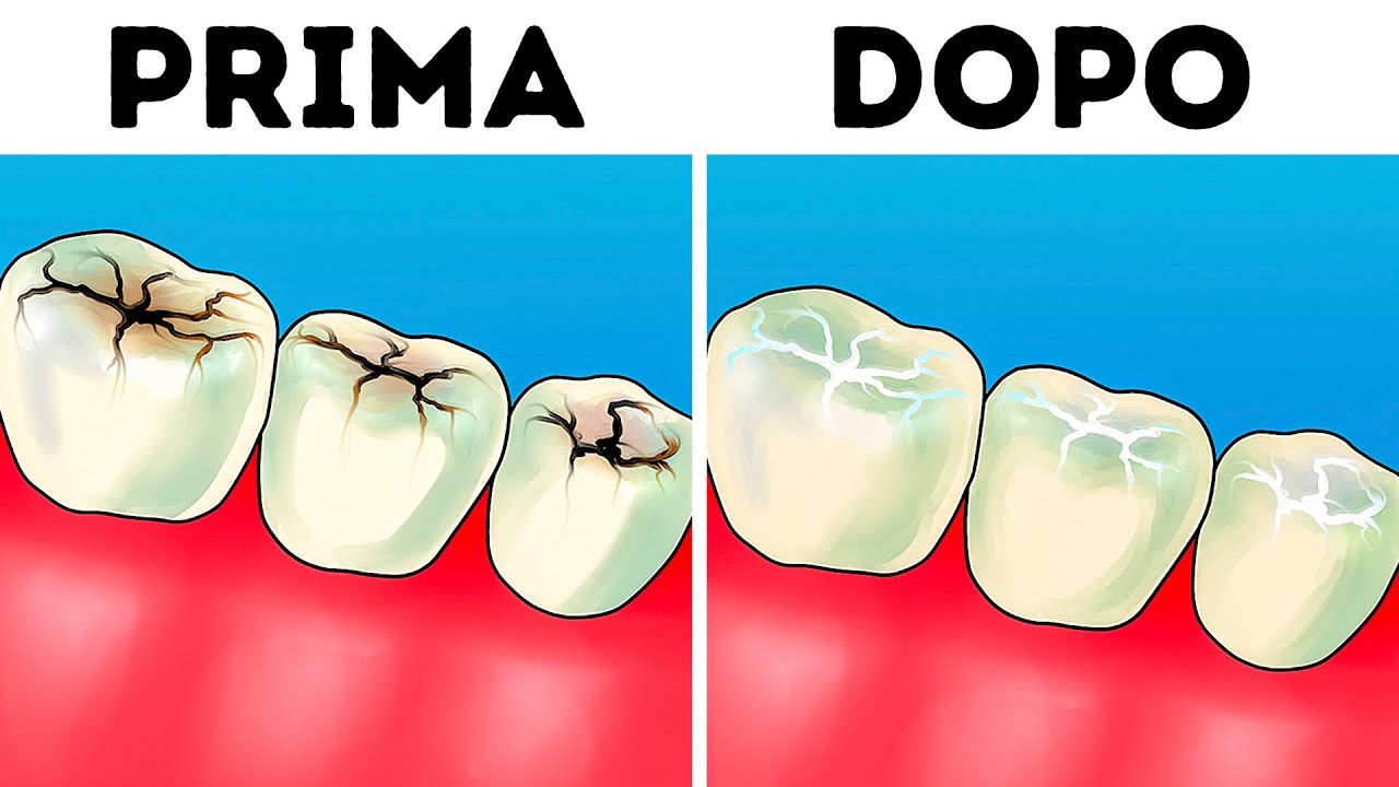 8 Passaggi Per Rendere I Denti Più Bianchi a Casa Tua