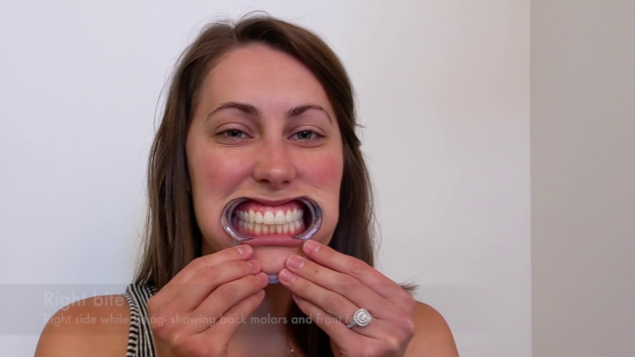 Virtual Visits! How to take your pictures! | Paschal Orthodontics | Madison, GA