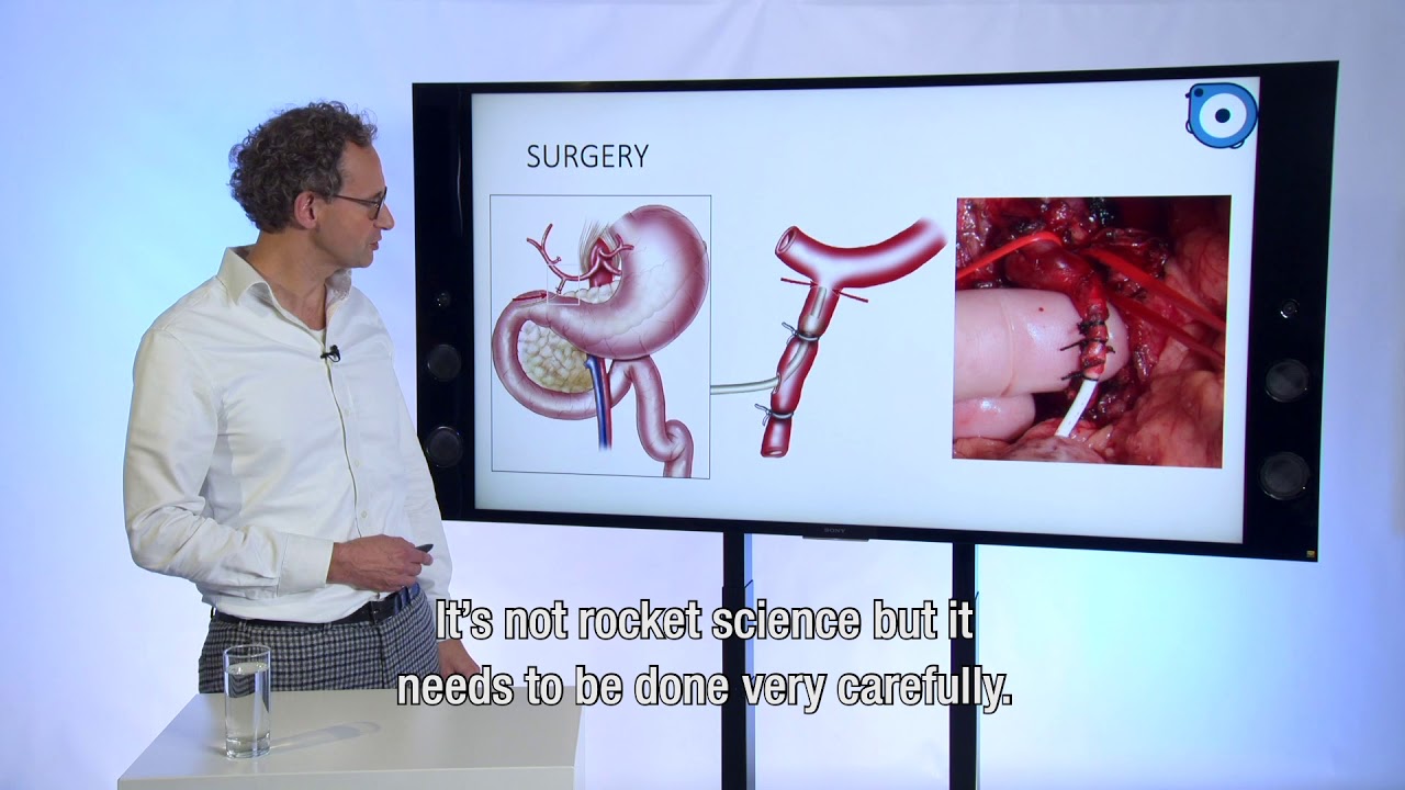 Regional chemotherapy for liver tumors