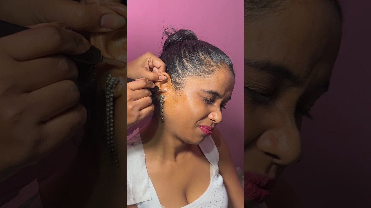 Dirty ear Wax Removal and Cleaning Process Full VideoOut#asmr#shorts#earwaxremoval#earwax#satisfying