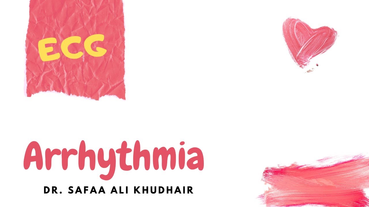 Arrhythmia and  Heart Block - ECG - Dr. Safaa Ali Khudhair