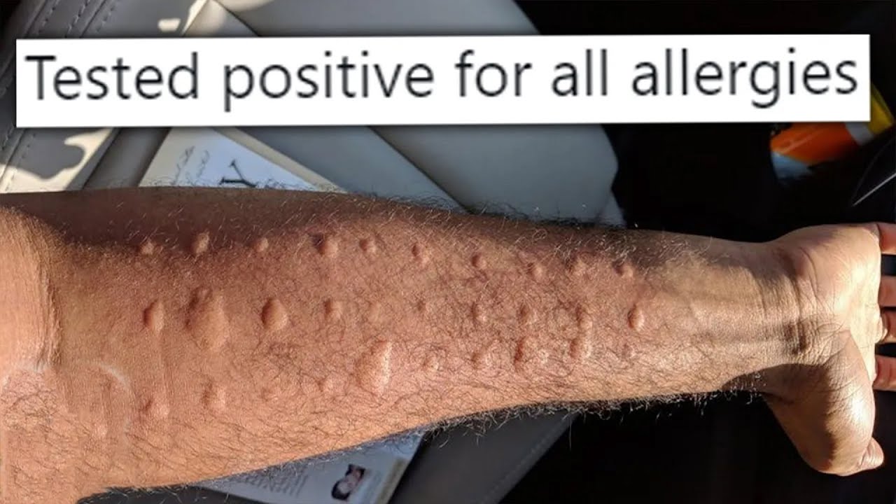 THE BEST OF r/WELLTHATSUCKS