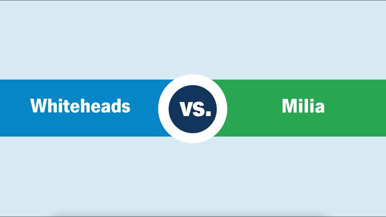 Whiteheads and Milia: What&rsquo;s the Difference?