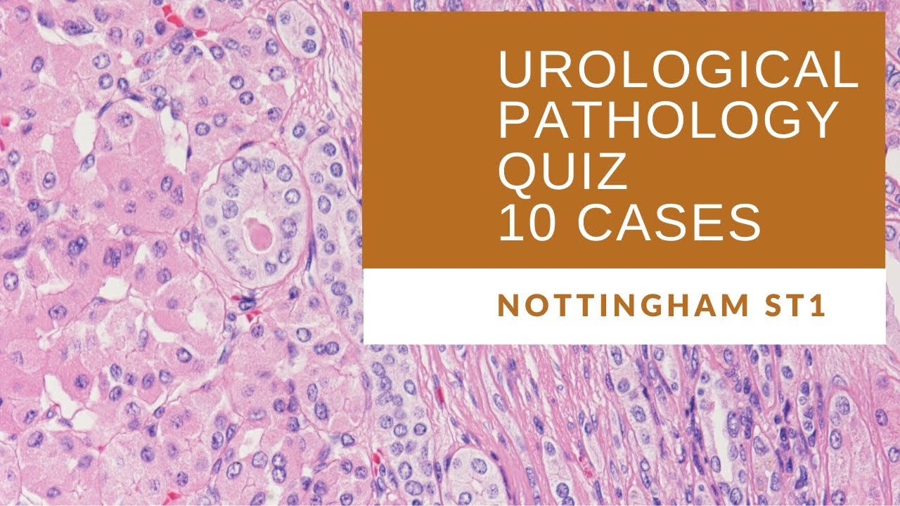 Urological Pathology Quiz - 10 cases for first year cell path trainees