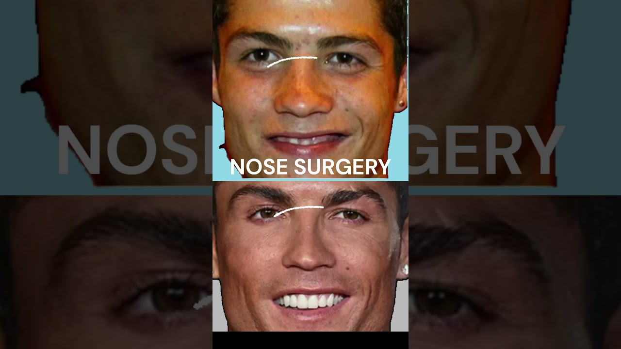 Cristian Ronaldo NEW FACE - CR7 Plastic Surgery