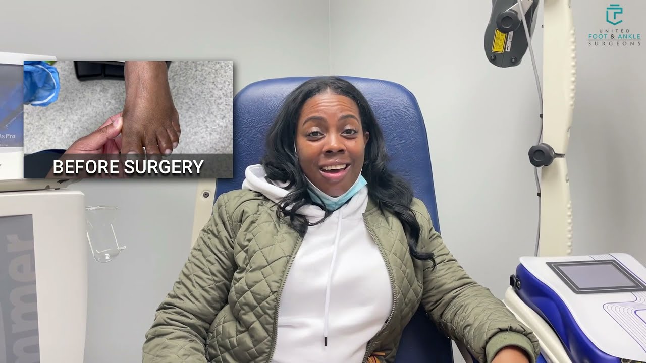 Minimally Invasive Bunion Surgery Patient Testimonial  │ Dr. TJ Ahn