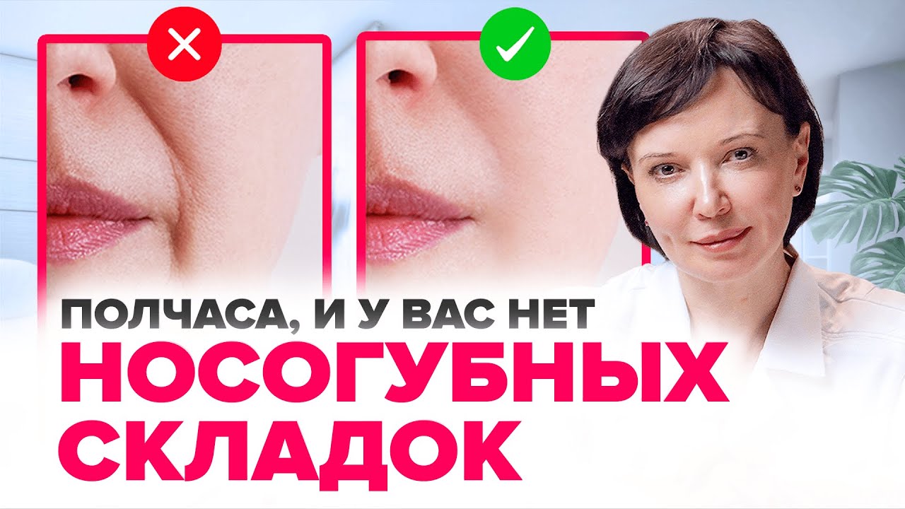 Как убрать носогубные складки. Убираем носогубки в кабинете у косметолога | Ирина Рахова