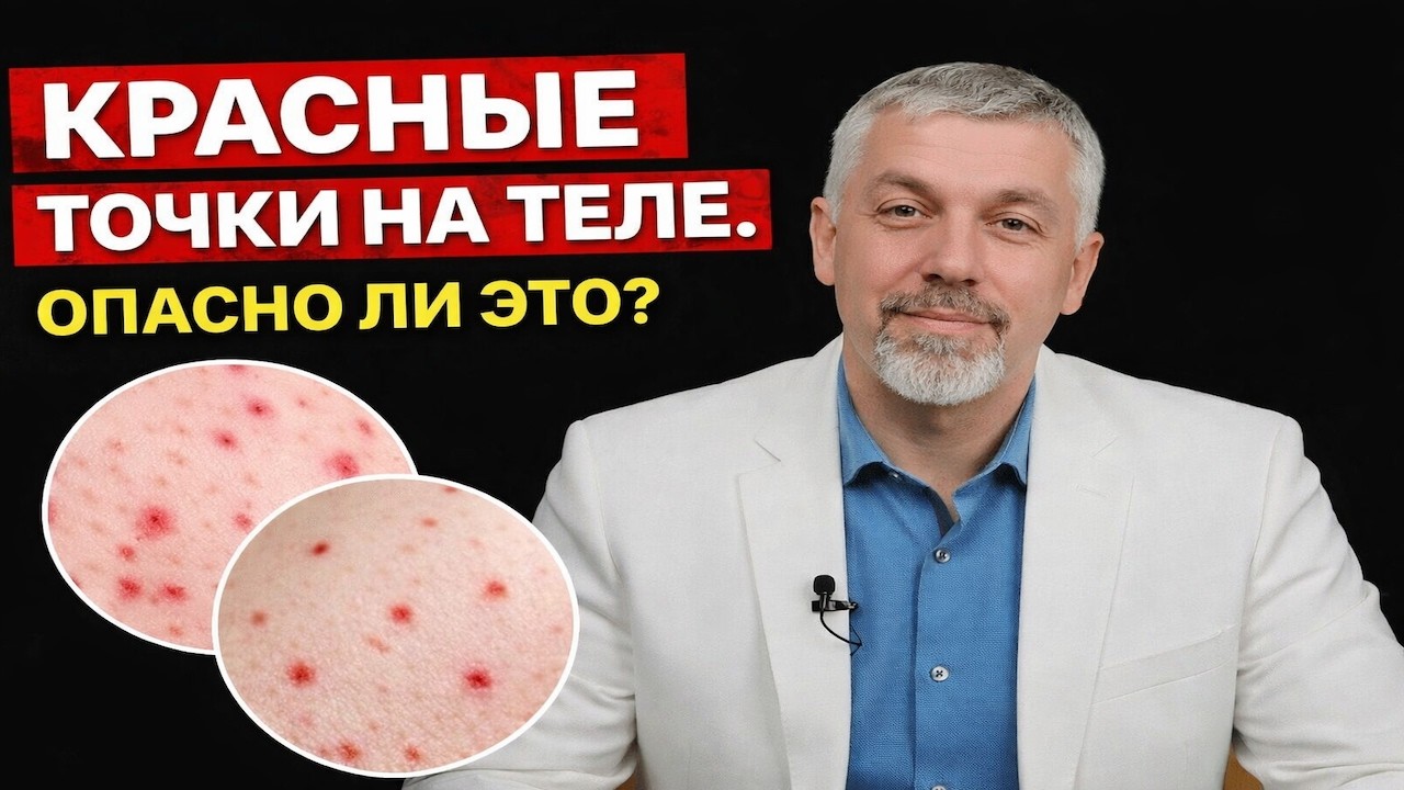 Ваше тело в «метках»  кто рисует красные точки на вашей коже  Честный разбор без цензуры  1080p