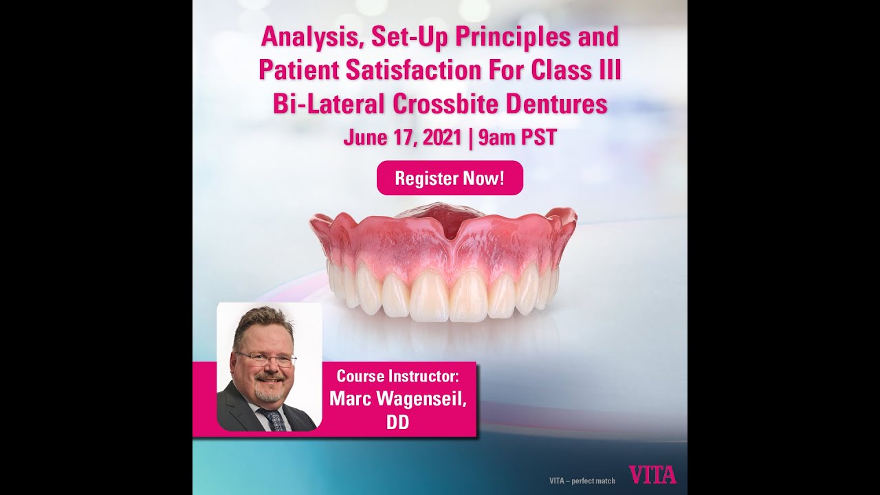 Analysis, Set Up Principles and Patient Satisfaction For Class III Bi Lateral Crossbite Dentures