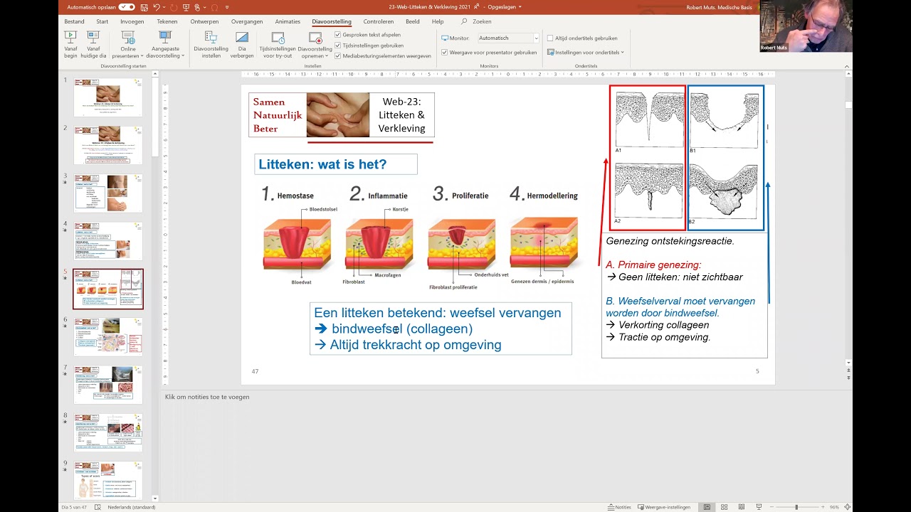 Webinar 23: Littekens en verklevingen