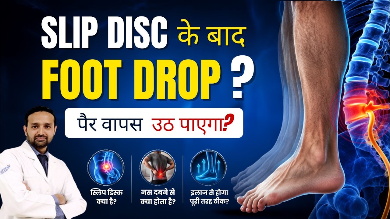 Foot Drop After Slip Disc: Is It Reversible? Recovery & Treatment Explained | Dr Devashish Sharma