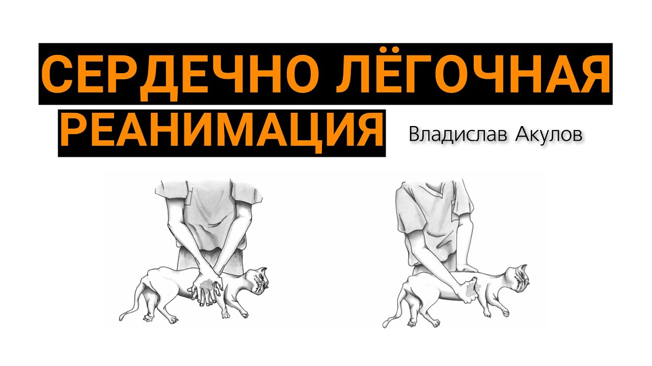Сердечно лёгочная реанимация