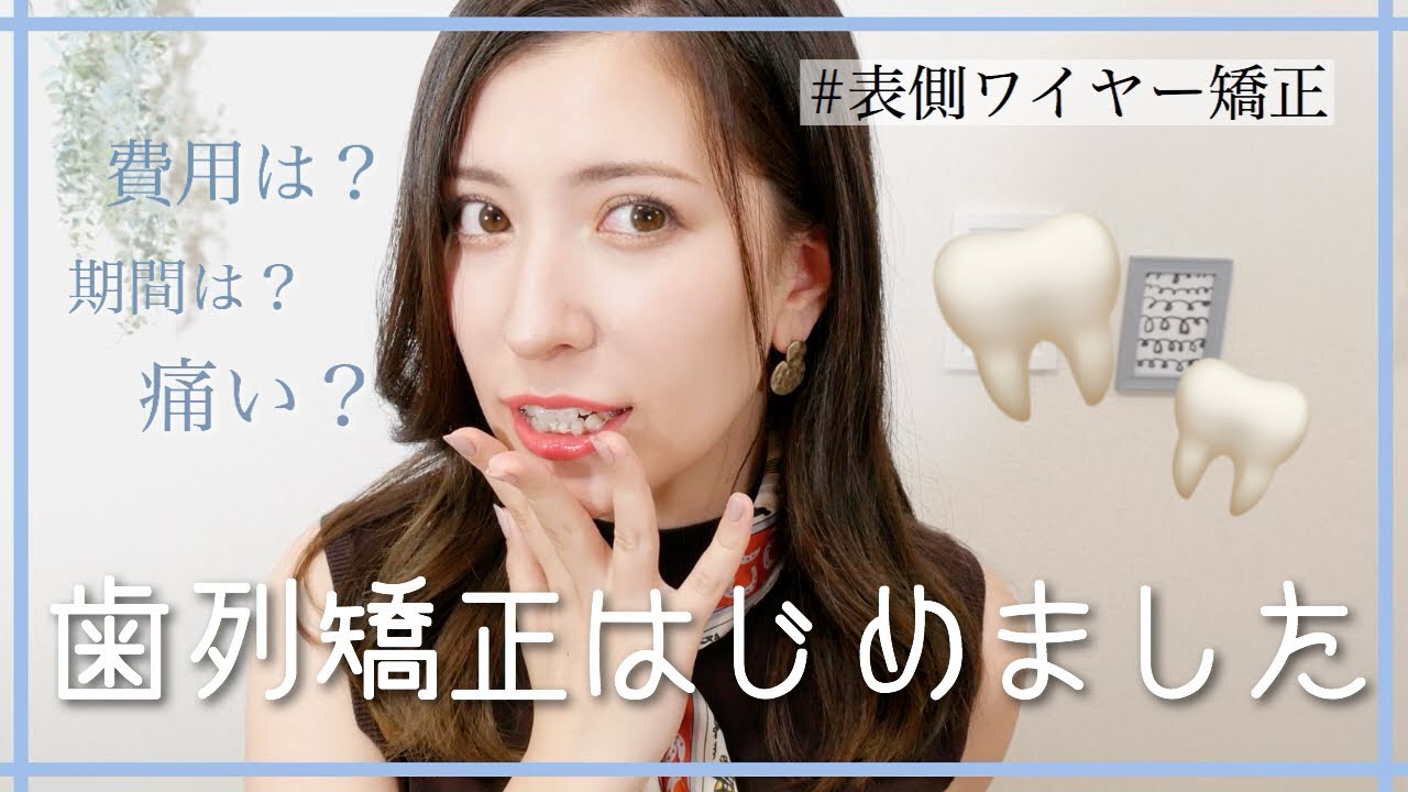 【ご報告】歯列矯正はじめました【表側ワイヤー矯正】【審美ブラケット 】