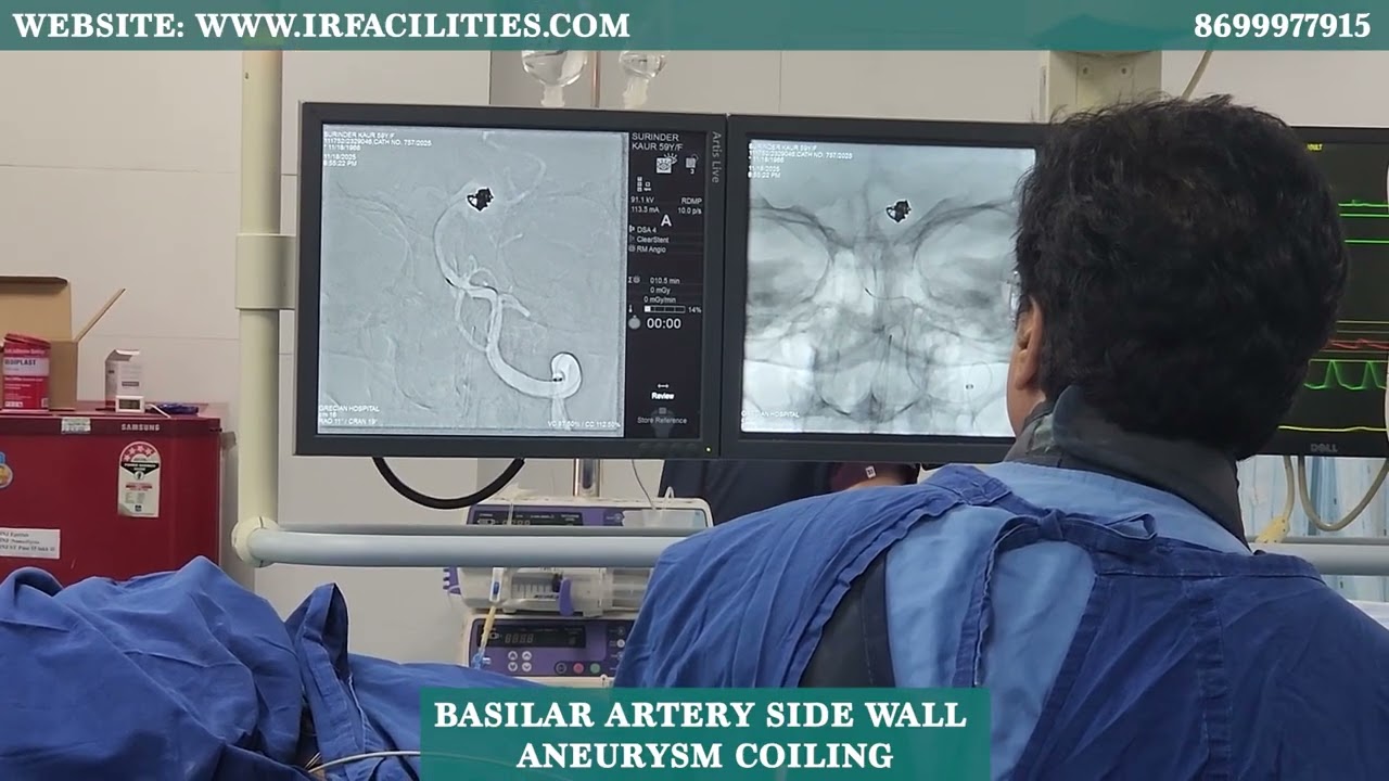 Basilar Artery Side Wall Aneurysm Coiling | Live Neurointervention- Dr. Sandeep Sharma- IRFacilities