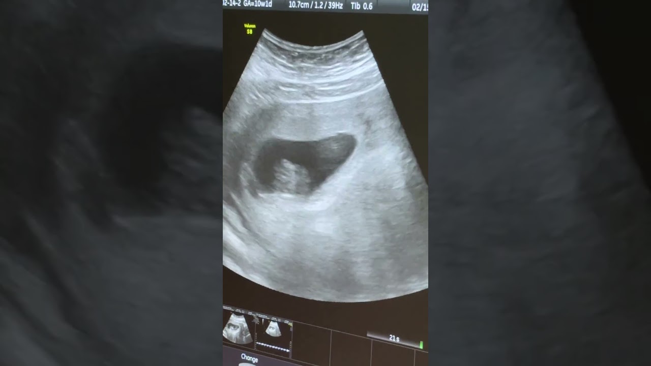 My grandson Reginald Marcel Elliott @ 10 weeks and one day on Feb 15,2026#Grateful#Blessed🙏💝👶