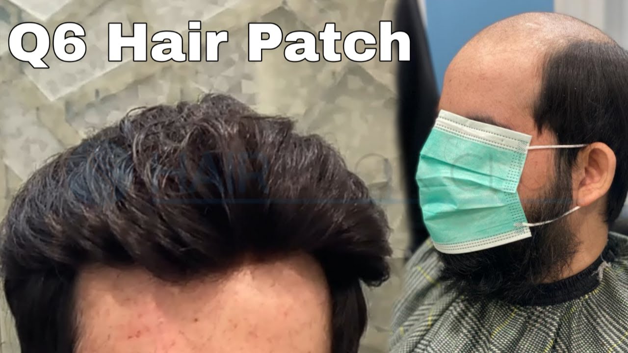 Q6 Hair Patch | Natural Front Hair Line🔥