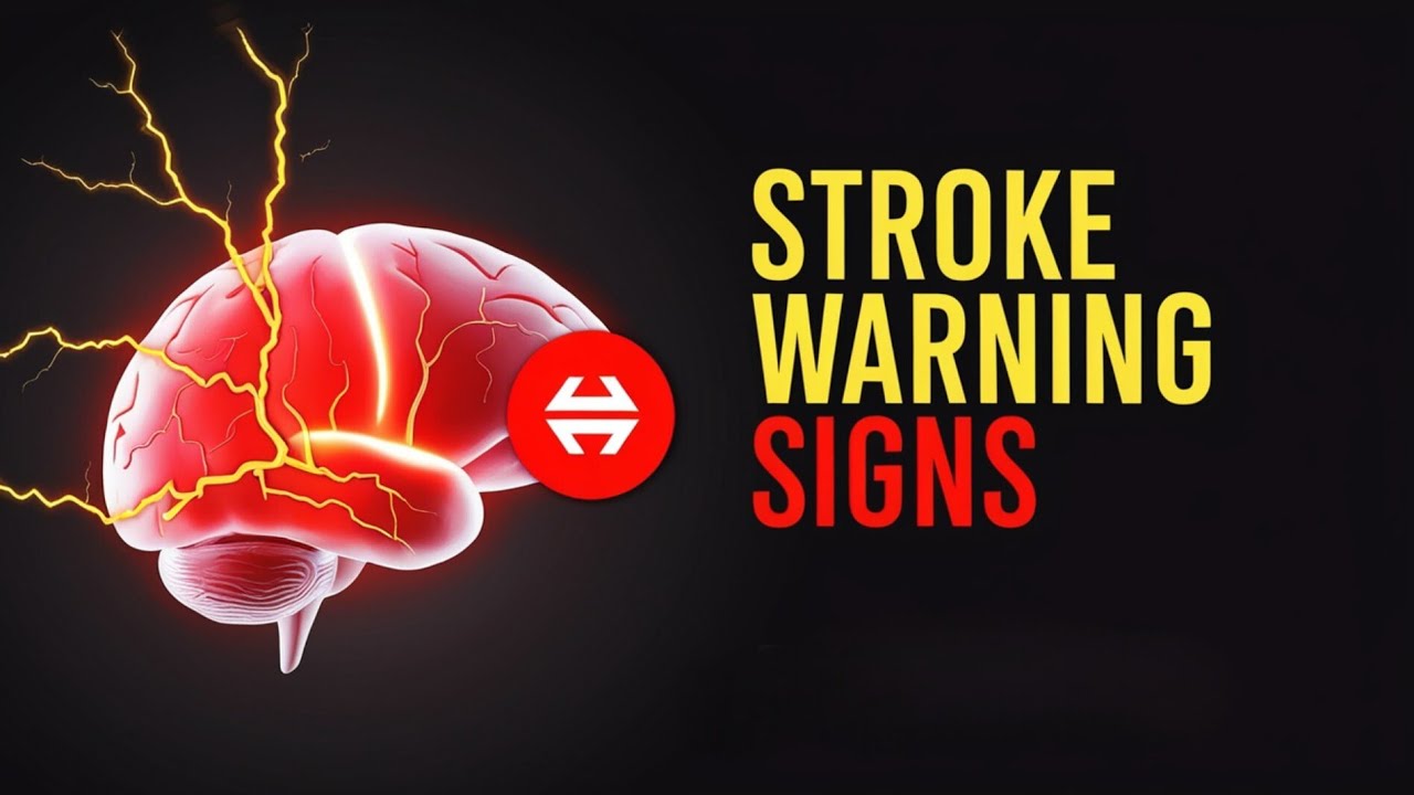 8 Early Warning Signs of Stroke Everyone Must Know