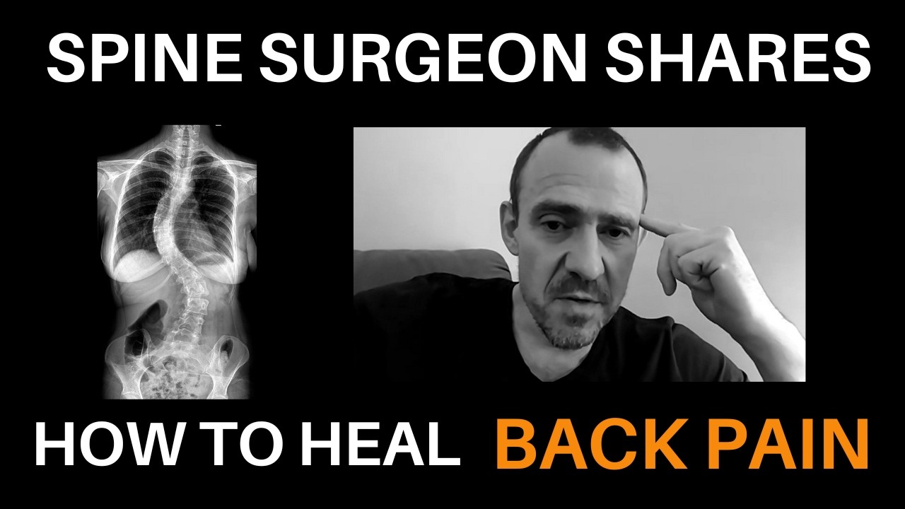 Spine Surgeon Says “You Need To Deadlift To Avoid Surgery For Stenosis & Spondylolisthesis”