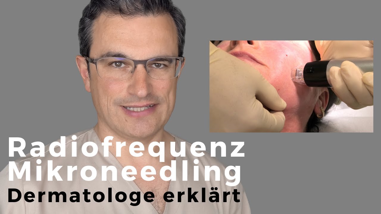 RADIOFREQUENZ MIKRONEEDLING mit dem Genius. DERMATOLOGE erkl&auml;rt die Anwendung