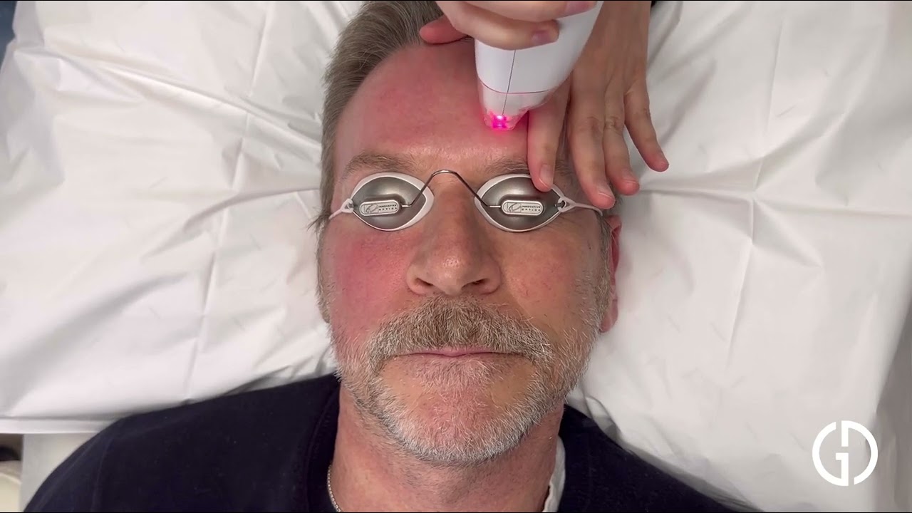 Lutronic Ultra | Geria Dermatology