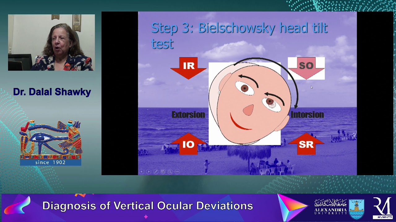 Vertical Ocular Deviations,  Prof Dalal Shawky , Alexandria University , Egypt