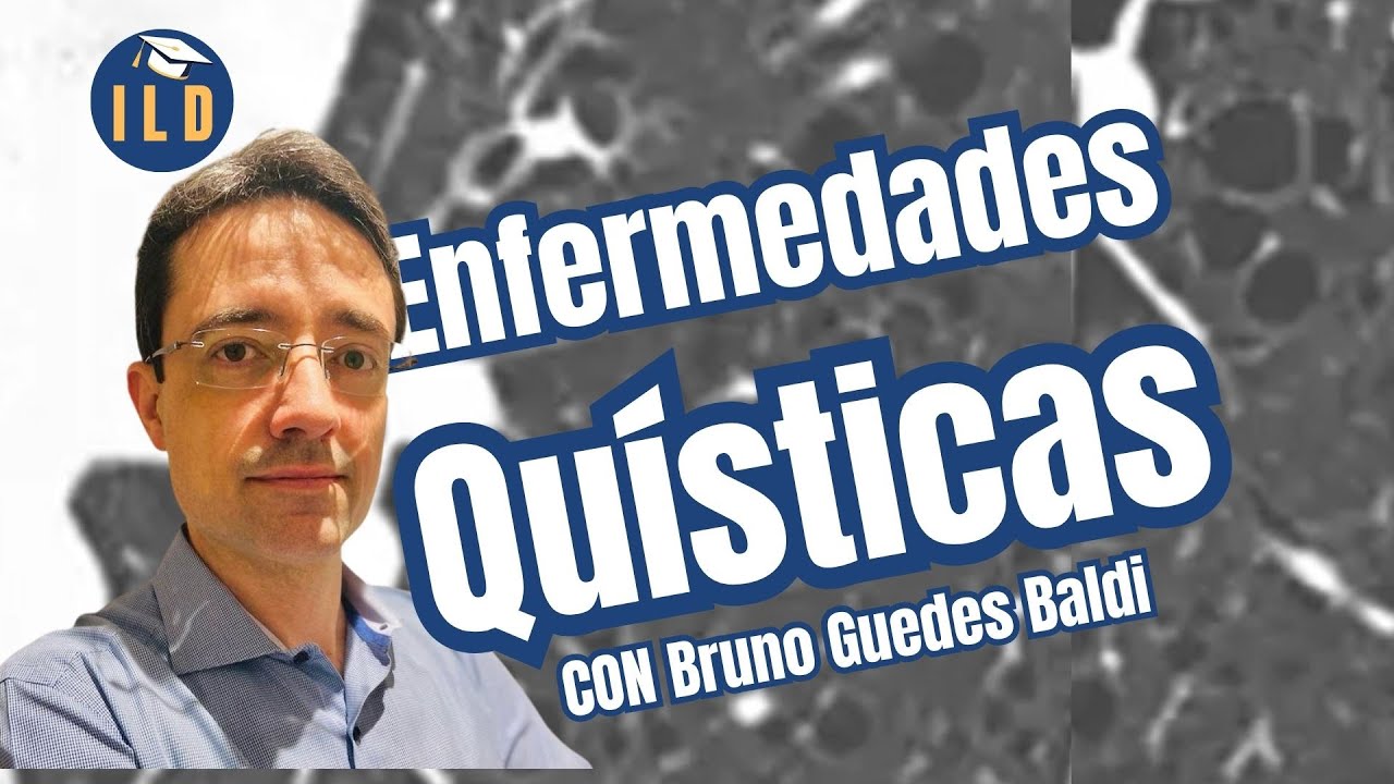 🔎Enfermedades Quísticas Pulmonares: Diagnóstico Diferencial Paso a Paso con Dr. Bruno Guedes Baldi