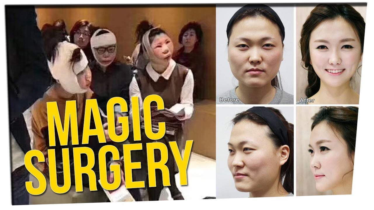 Plastic Surgery Patients Don't Match Passports? ft. DavidSoComedy