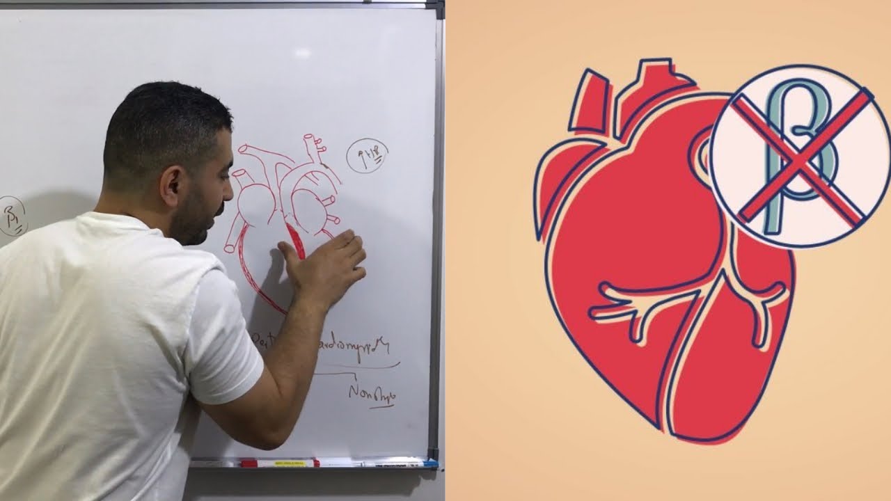 ال  beta blockers  بتزود من ال  cardiac output !! في الحالة دي