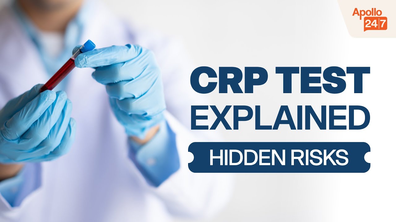 CRP Test &ndash; The Key to Understanding Your Body&rsquo;s Inflammation