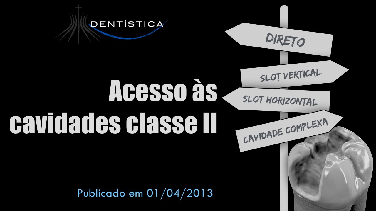 Acesso às cavidades classe II