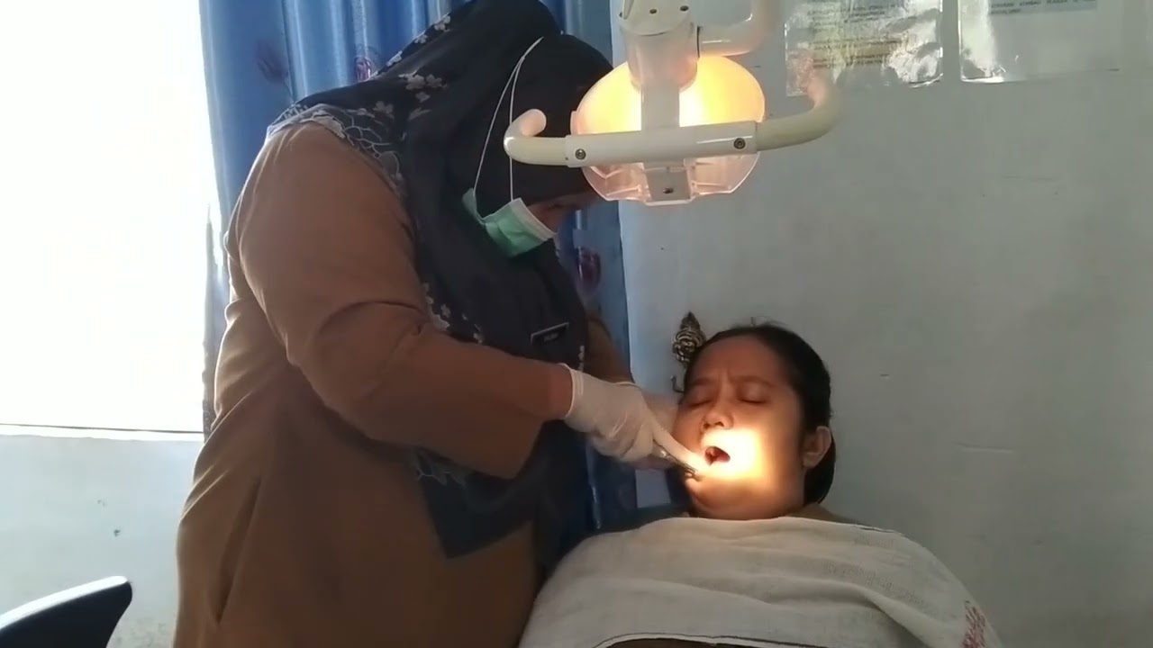 pencabutan gigi permanen yang ke 2