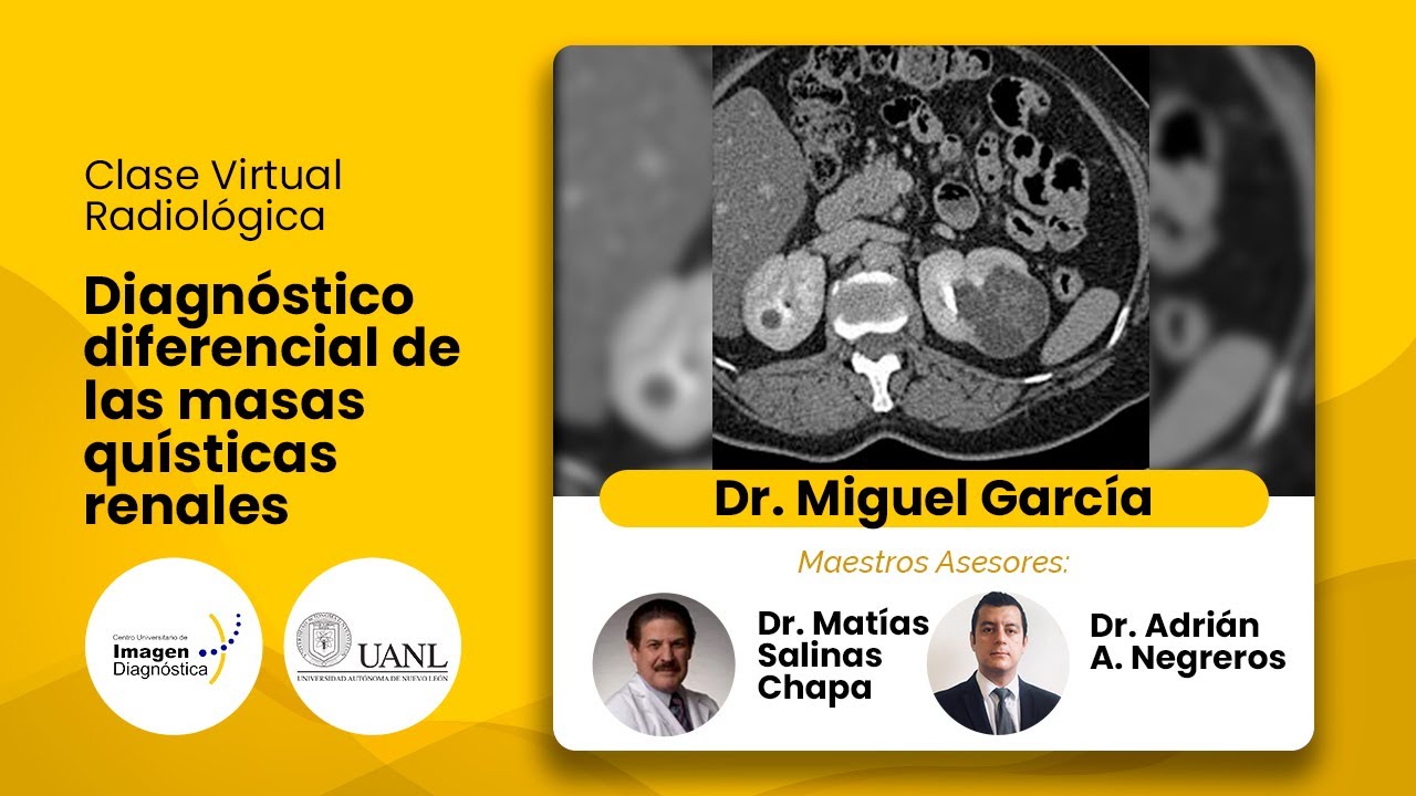 Diagnostico diferencial de las masas quísticas renales Dr. Miguel García