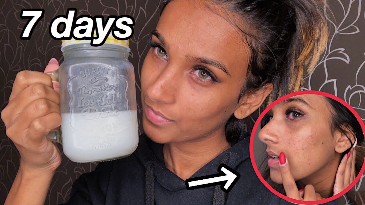 I Used RICE WATER On My Face For One Week || Before And After Results