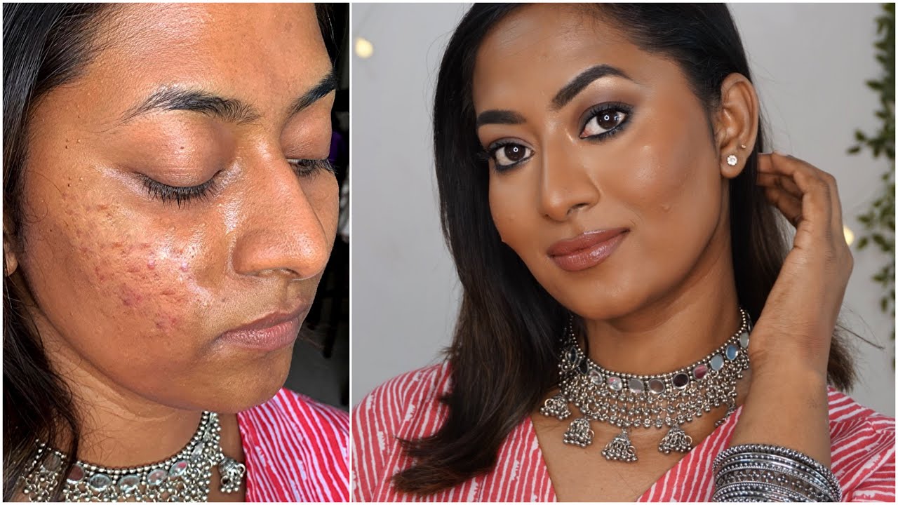 Dark skin makeup tutorial ✨| how to cover hyperpigmentation & acne scars ?