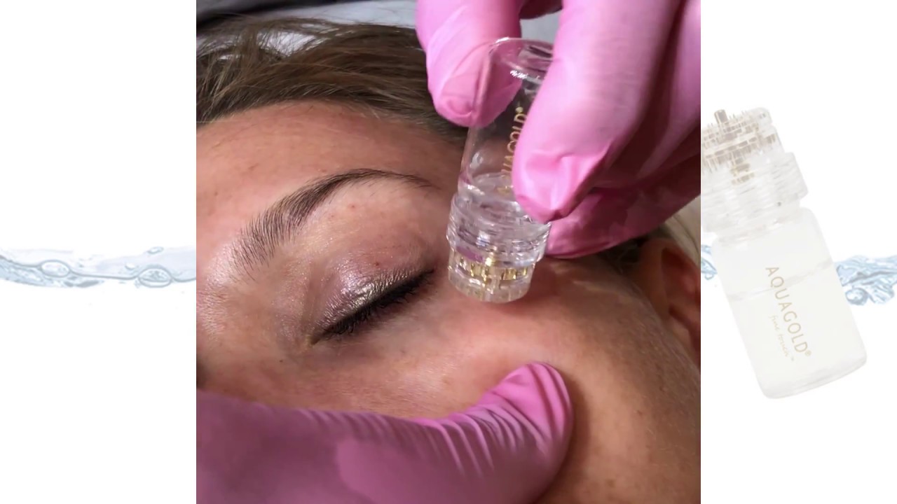 AQUAGOLD® fine touch™ - Dr. Salima El-Hage