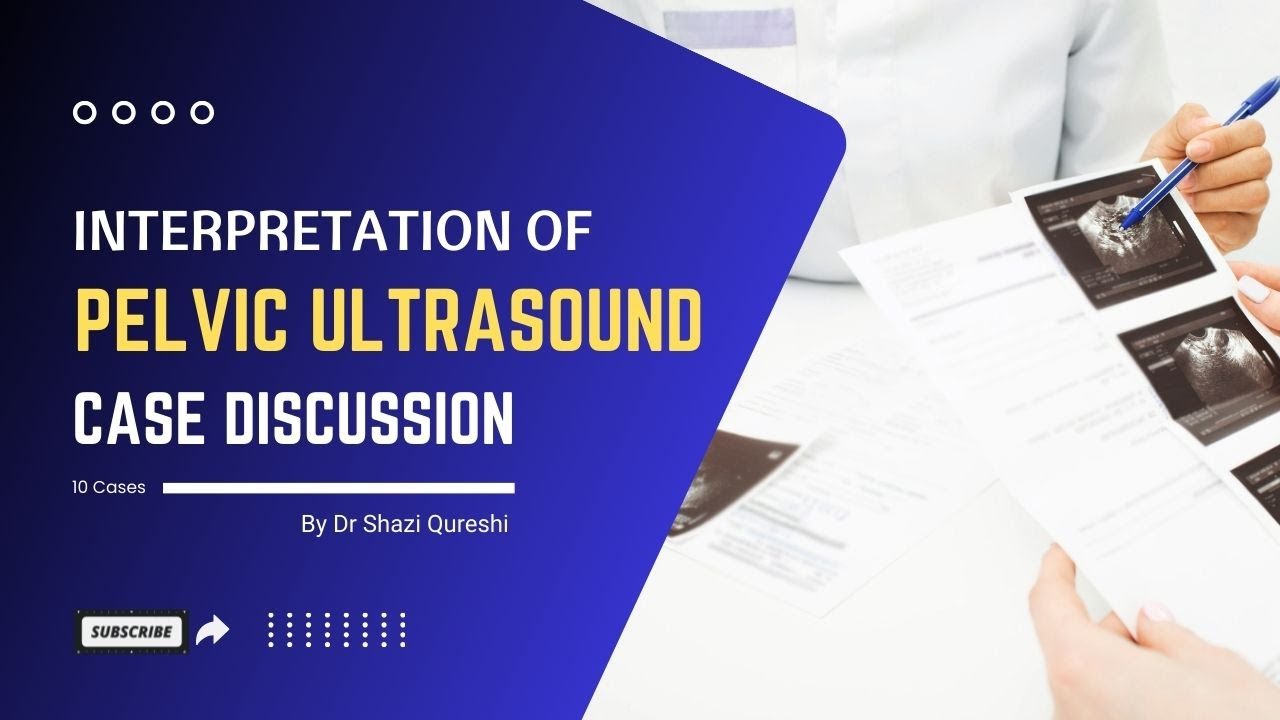 Interpretation of Pelvic Ultrasound Case discussion