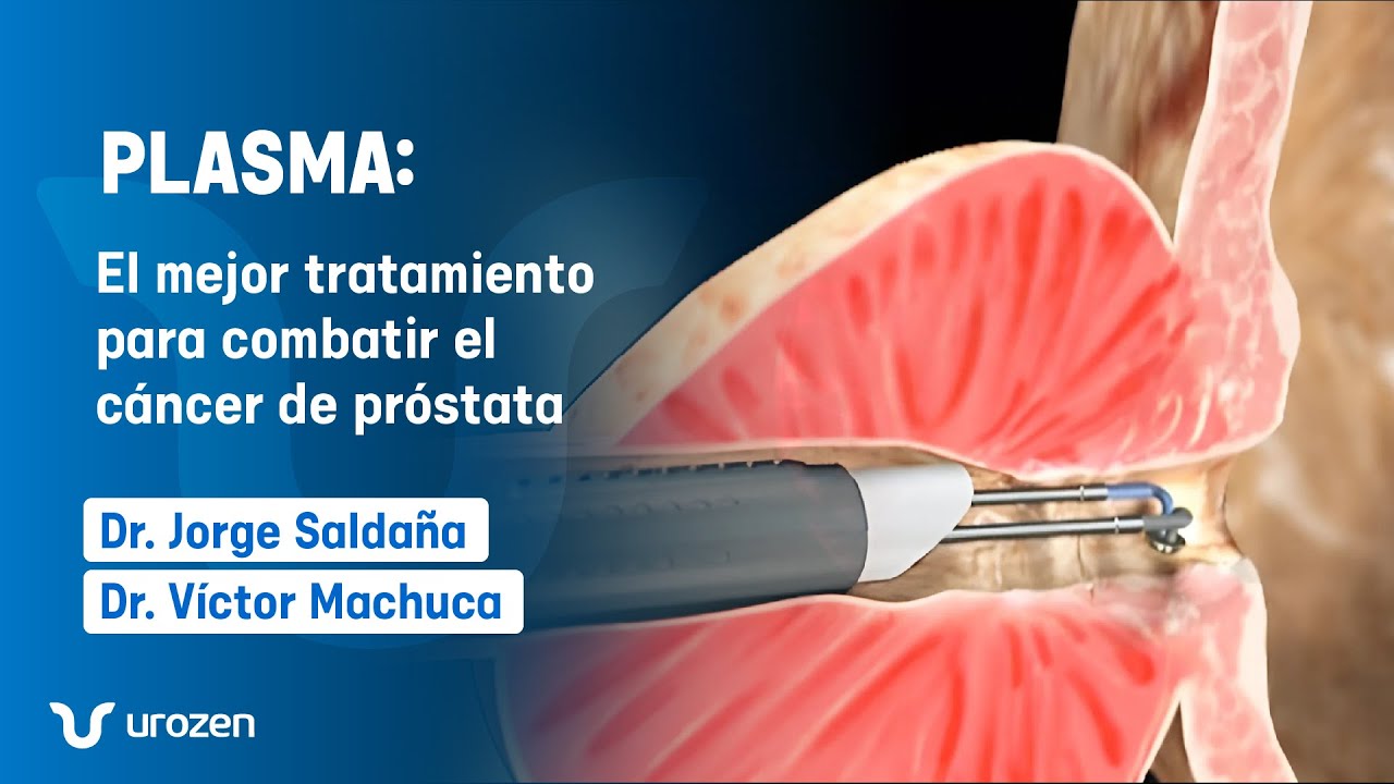 🚨¡Tratamiento para el Agrandamiento de Próstata! - Vaporización con PLASMA