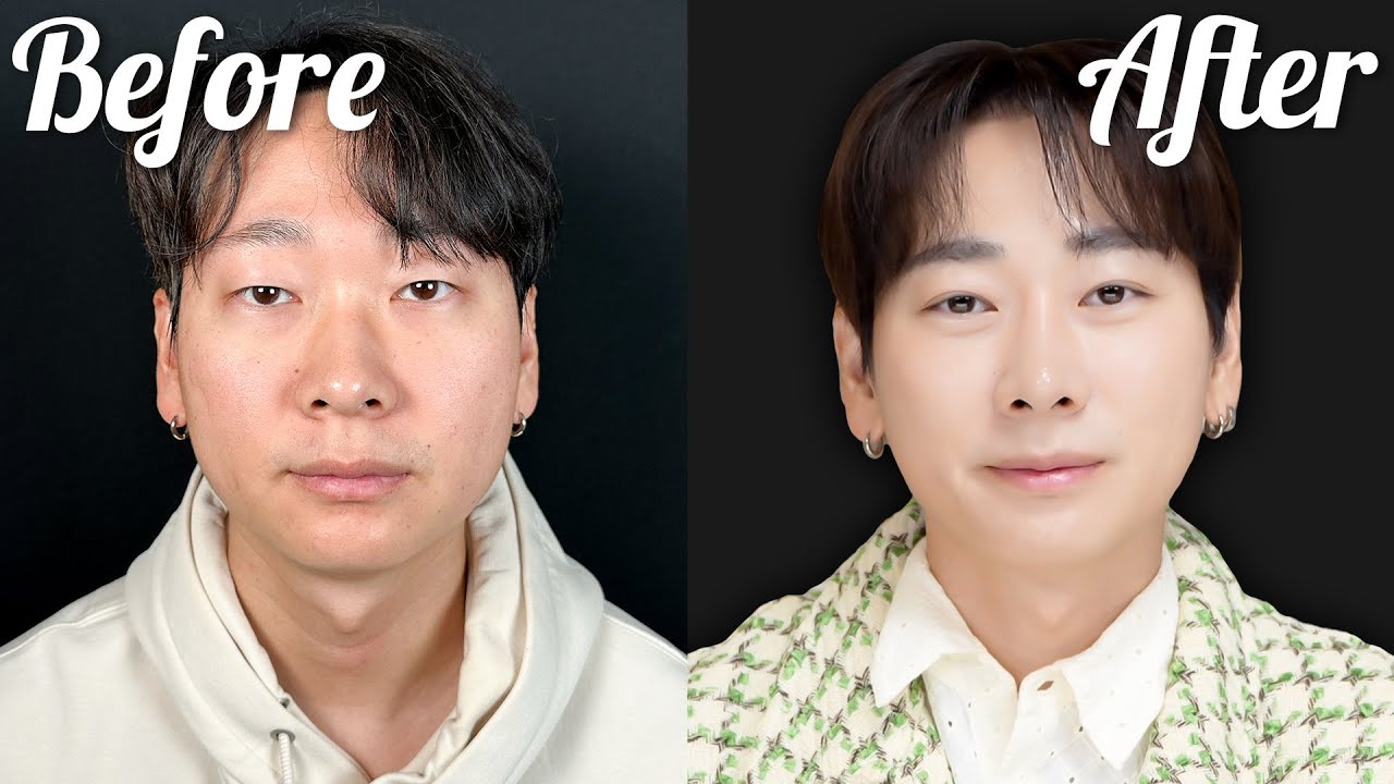 ブスは国に帰れ！目つきが悪いと言われた韓国人が整形して人生が変わった