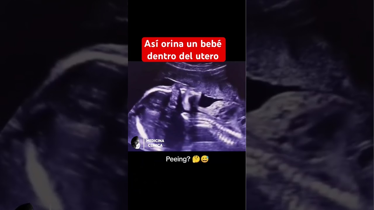 Beb&eacute; orinando dentro del utero.