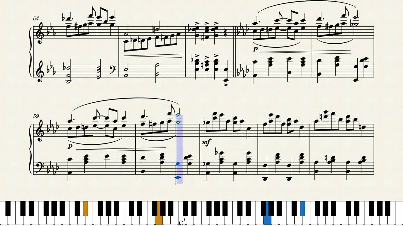 Nervous Fingers by J. Paques (1930)