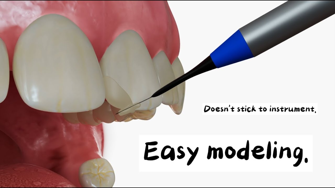 Nanohybrid Composite Tooth Fillings (Class I - VI): Visalys® Flow & Visalys® Fill #ColorStable