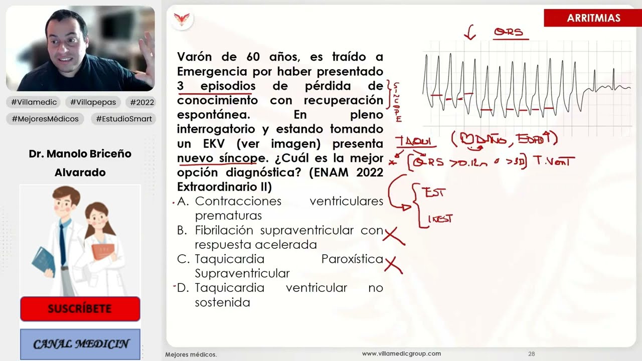 PREGUNTAS ENAM DE ARRITMIAS PRIMERA PARTE - CARDIOLOGÍA - VILLAMEDIC