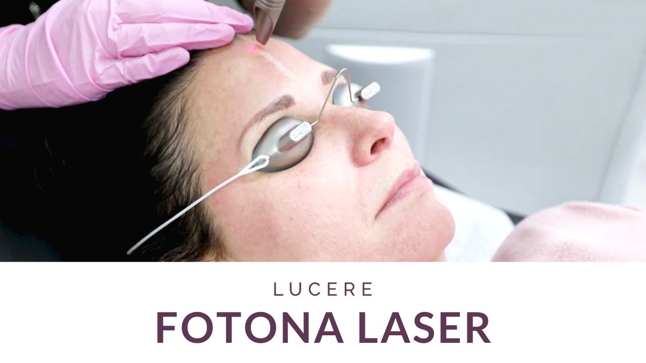 Lucere's Fotona Laser Treatment.