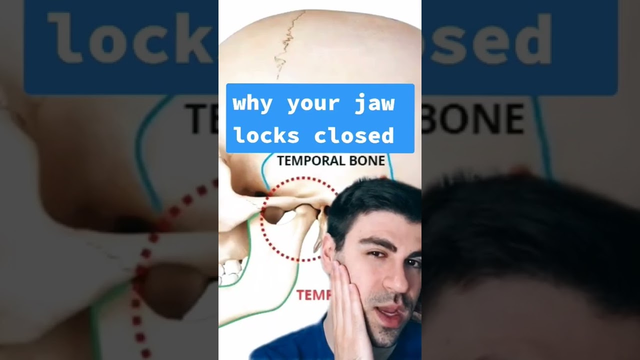 Why Your Jaw Locks CLOSED - Dentist Explains