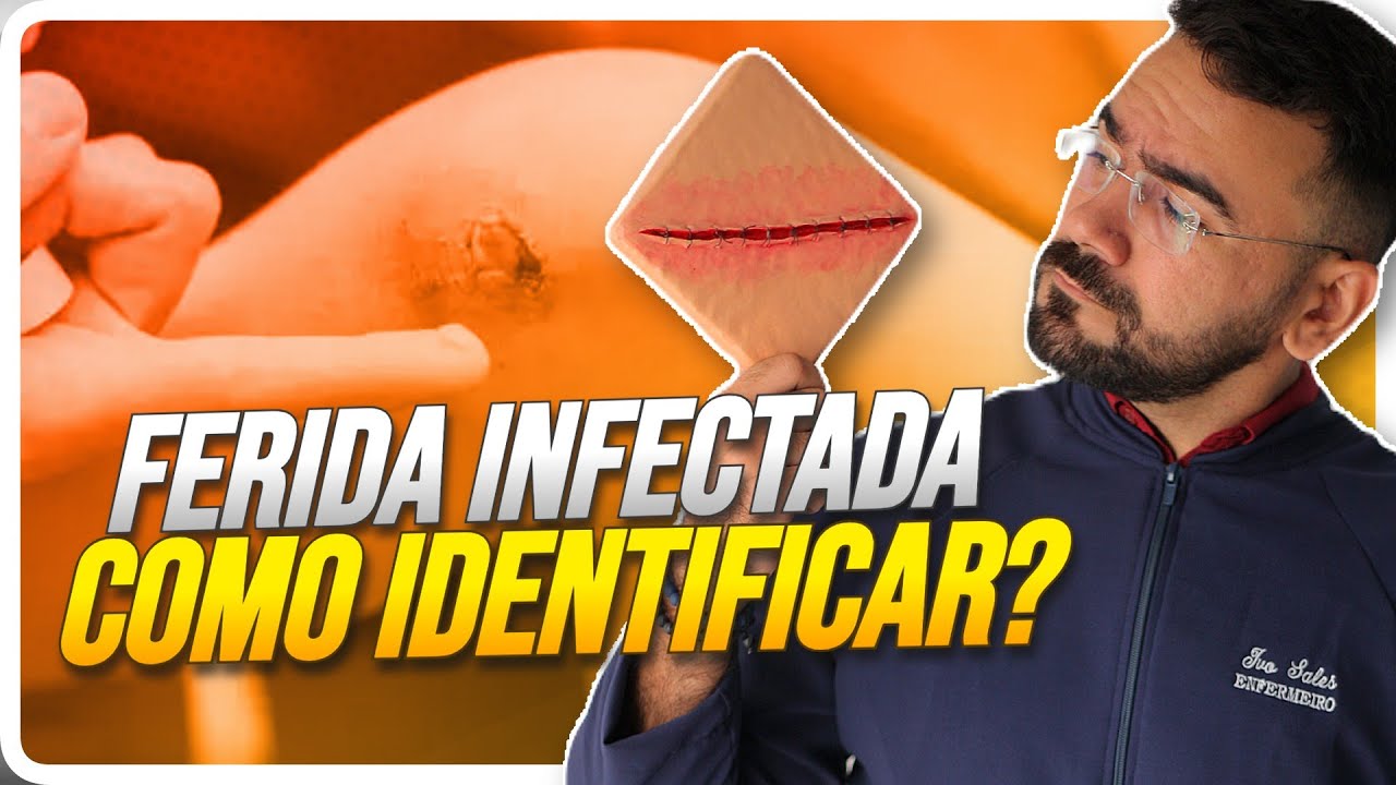 COMO SABER SE A FERIDA EST&Aacute; INFECTADA? SINAIS E SINTOMAS DA INFEC&Ccedil;&Atilde;O NA FERIDA