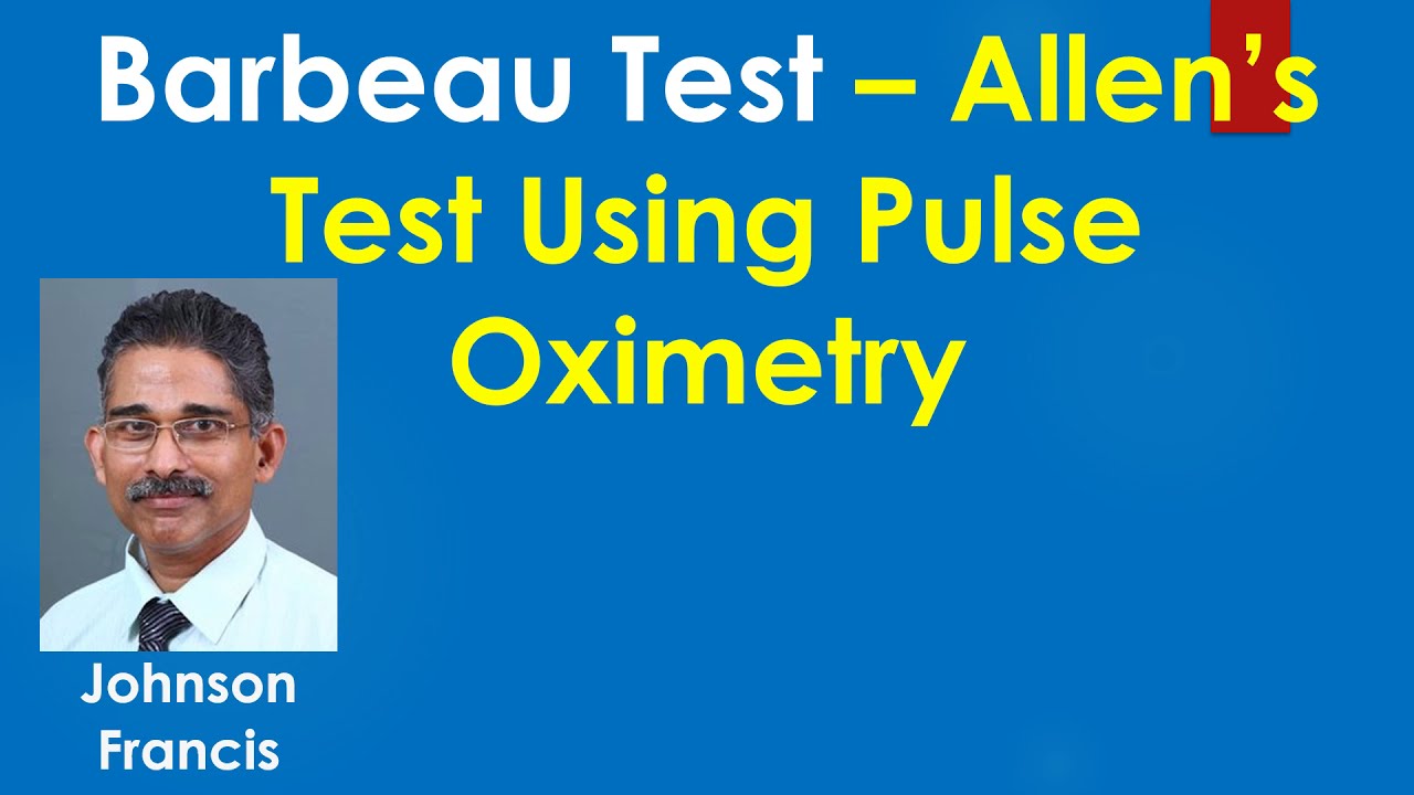 Barbeau Test – Allen’s Test Using Pulse Oximetry