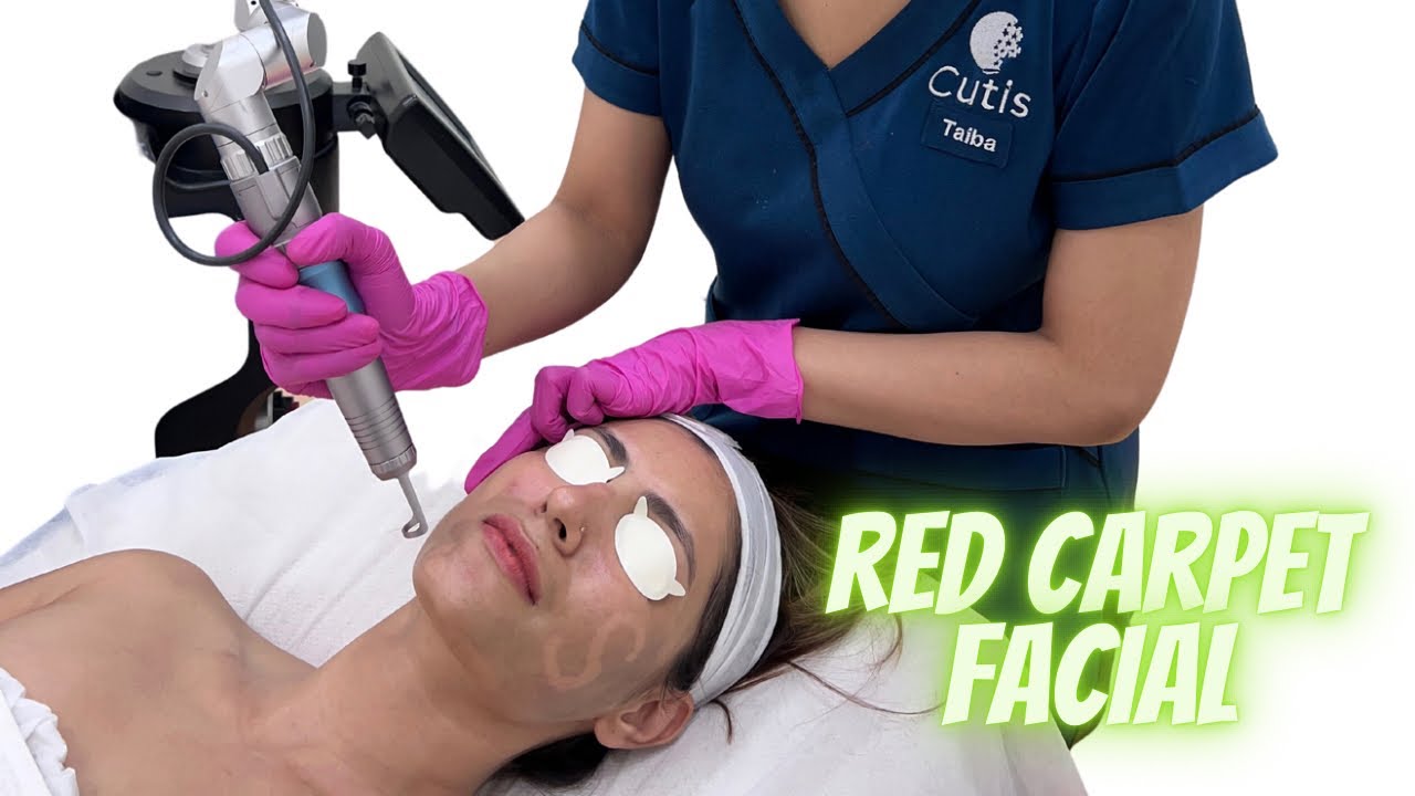 Carbon Laser Facial | Cutis Skin Solution | Red carpet Facial