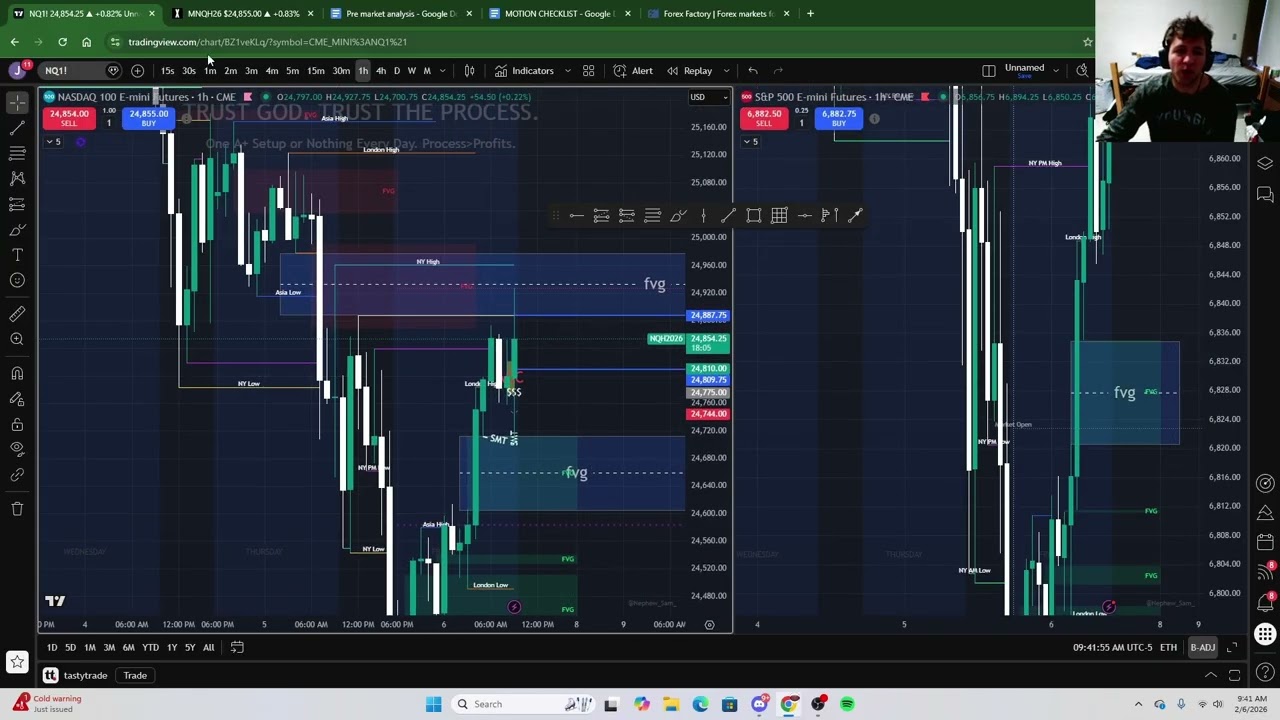 How I Made 100 Billion Dollars Trading NQ Today (2 Min Work Day A+ Setup)