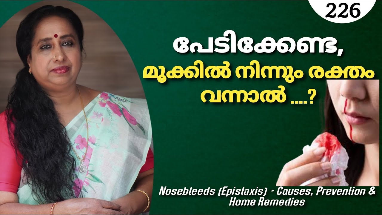 പേടിക്കേണ്ട, മൂക്കിൽ നിന്നും രക്തം വന്നാൽ/Nosebleeds (Epistaxis)-Causes, Prevention & Home Remedies